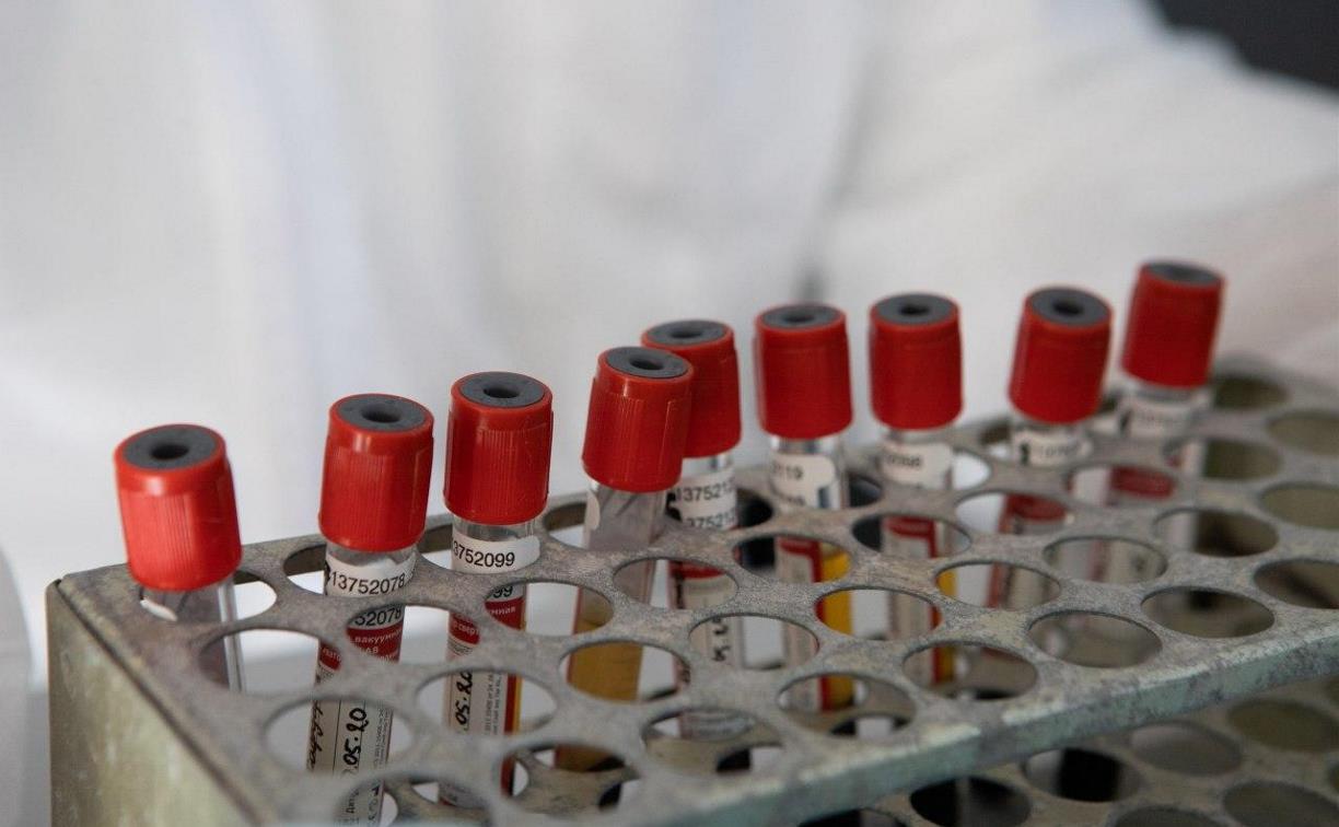 В Тульской области за сутки зарегистрирован 31 случай коронавируса