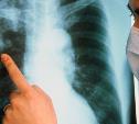 В Новомосковске пациент с туберкулезом сбежал от врачей