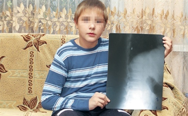 За ранение подростка из пневматики алексинец сядет на 5 лет