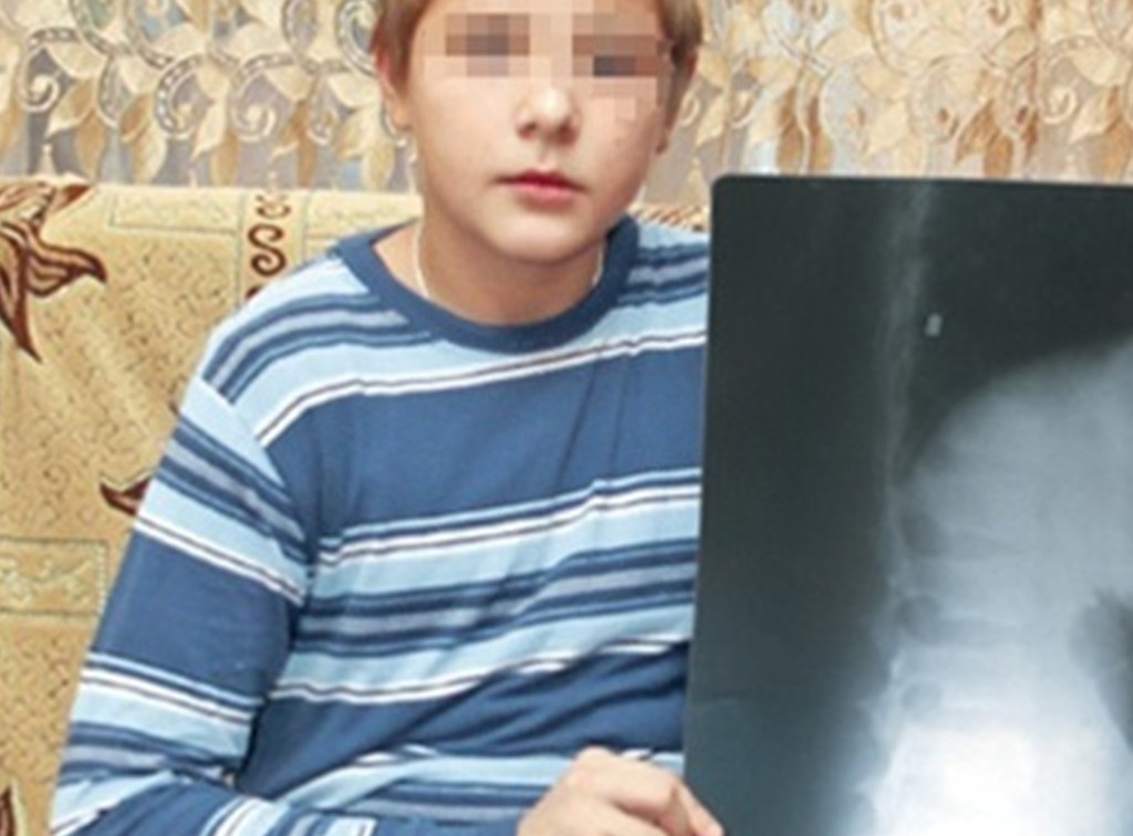 За ранение подростка из пневматики алексинец сядет на 5 лет