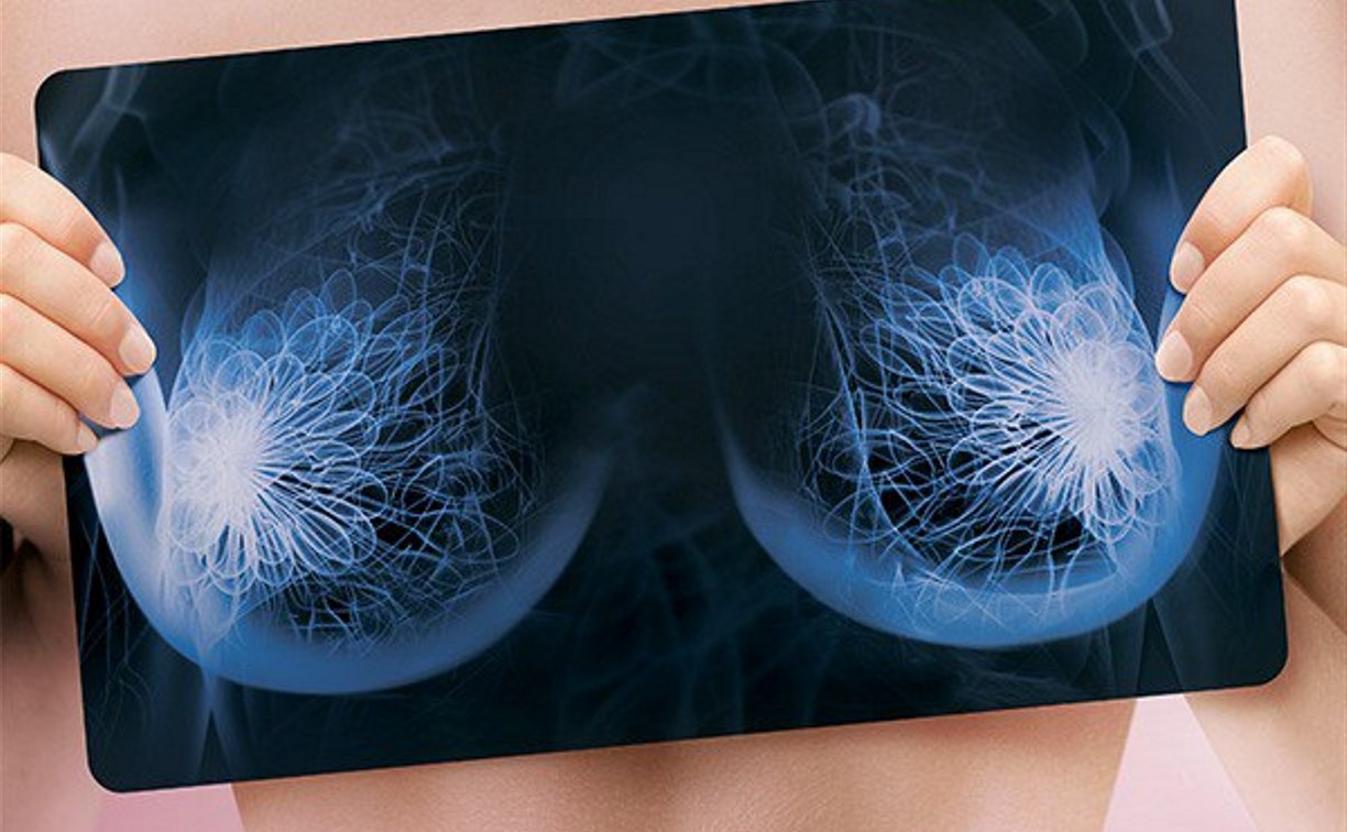 Тулячек приглашают на бесплатный осмотр маммологов для профилактики рака груди