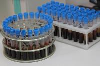 Тестирование на антитела к COVID-19, Фото: 30